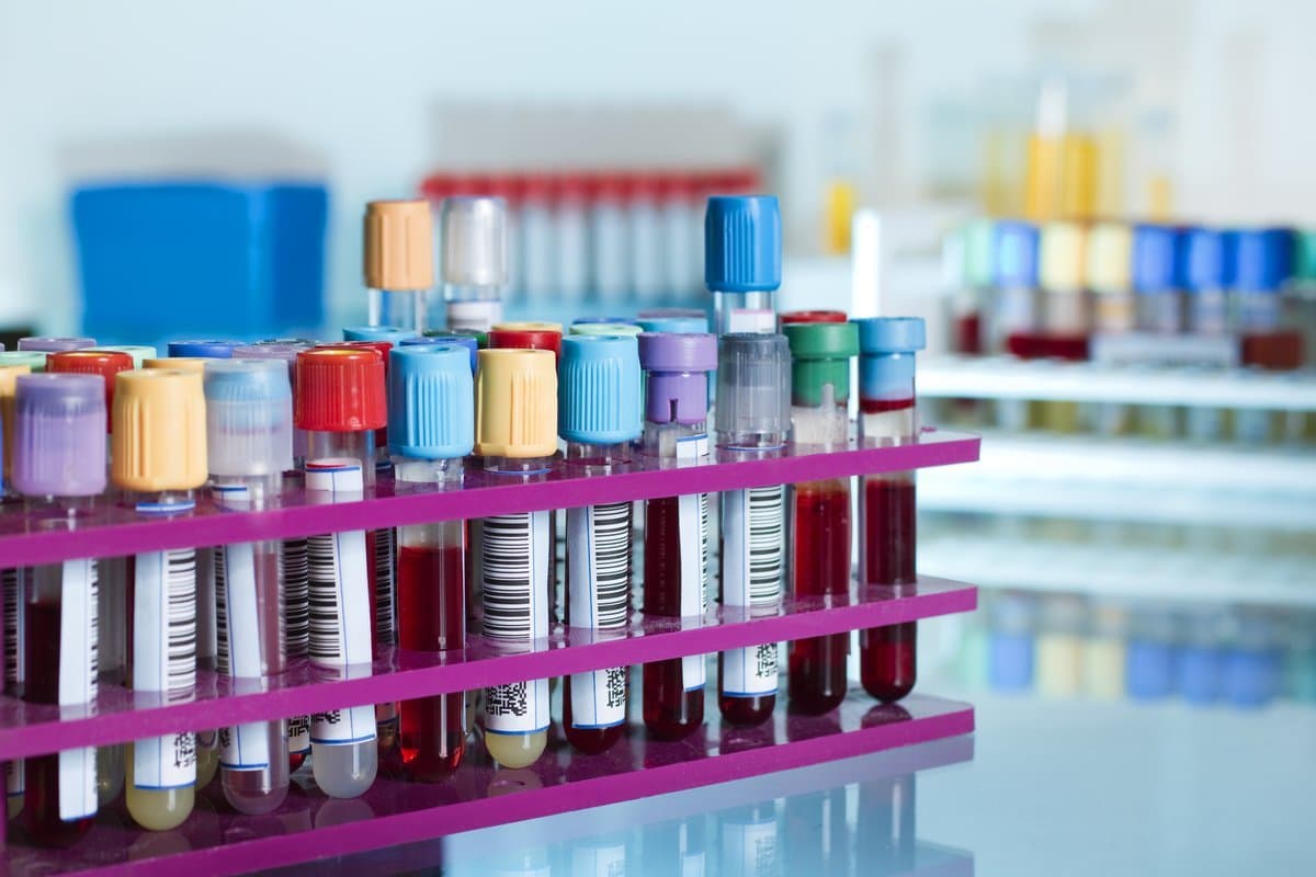 Pathology laboratory specimens and sample processing workflow